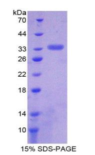 Figure 1. SDS-PAGE