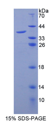 Figure 1. SDS-PAGE