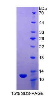 Figure 1. SDS-PAGE