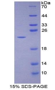 Figure 1. SDS-PAGE
