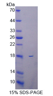 Figure 1. SDS-PAGE