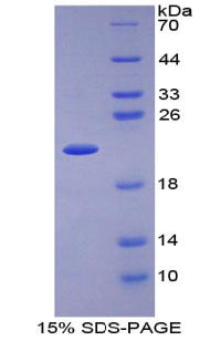 Figure 1. SDS-PAGE