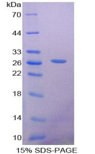 Figure 1. SDS-PAGE