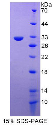 Figure 1. SDS-PAGE