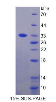 Figure 1. SDS-PAGE