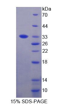 Figure 1. SDS-PAGE