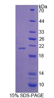 Figure 1. SDS-PAGE