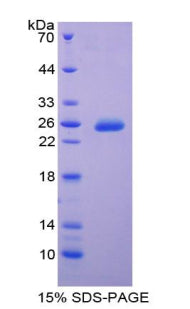 Figure 1. SDS-PAGE