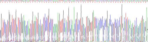 Recombinant Human Tumor Protein p53 (P53)