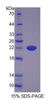 Figure 1. SDS-PAGE