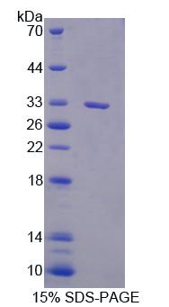 Figure 1. SDS-PAGE