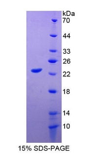 Figure 1. SDS-PAGE