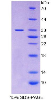 Figure 1. SDS-PAGE