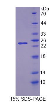 Figure 1. SDS-PAGE