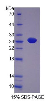 Figure 1. SDS-PAGE