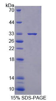Figure 1. SDS-PAGE
