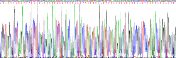 Eukaryotic Oncostatin M (OSM), RPU54752