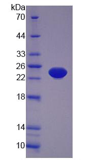 Figure 3. SDS-PAGE