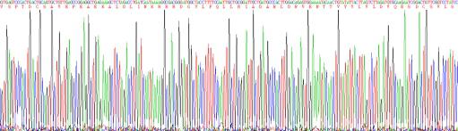 Eukaryotic Human Histidine Rich Glycoprotein (HRG)