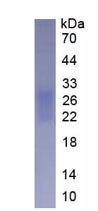 Human Fibronectin Type III Domain Containing Protein 5 (FNDC5), Active Protein