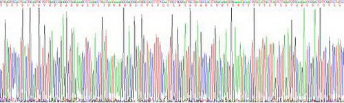 Human Histidine Rich Glycoprotein (HRG), Active Protein