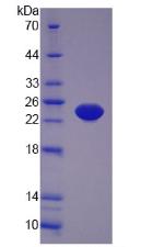 Mouse Tumor Necrosis Factor Alpha (TNFa), Active Protein