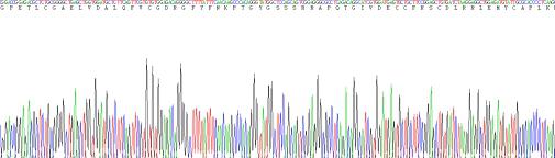 Human Insulin Like Growth Factor 1 (IGF1), Active Protein