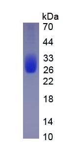 Figure 2. SDS-PAGE