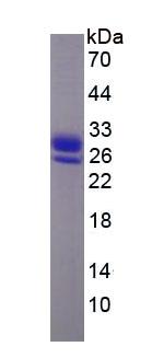 Figure 3. SDS-PAGE