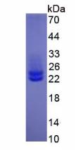 Human Interleukin 6 (IL6), Active Protein