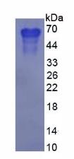 Human Osteopontin (OPN), Active Protein