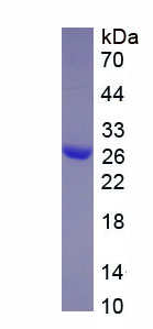 Figure 1. SDS-PAGE