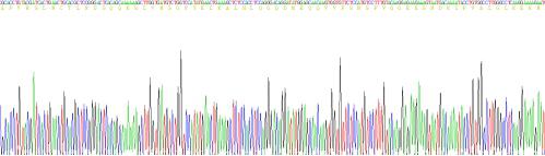Human Interleukin 1 Beta (IL1b), Active Protein