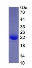 Human Interleukin 1 Beta (IL1b), Active Protein