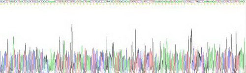 Human Interleukin 1 Beta (IL1b), Active Protein