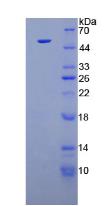 Human Fibroblast Growth Factor 1, Acidic (FGF1), Active Protein