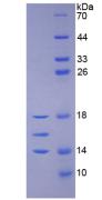 Human Interleukin 15 (IL15), Active Protein