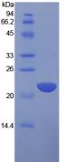 Figure 1. SDS-PAGE