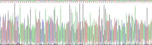 Human Protein Kinase R (PKR), Active Protein