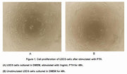 Active Parathyroid Hormone (PTH), RPU54913