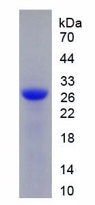 Figure 2. SDS-PAGE