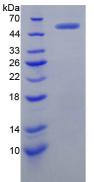 Human V-Myc Myelocytomatosis Viral Oncogene Homolog (MYC), Active Protein