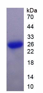 Figure 2. SDS-PAGE