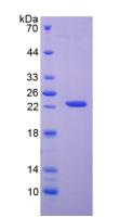 Figure 3. SDS-PAGE