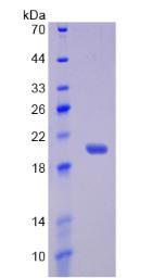 Figure 1. SDS-PAGE