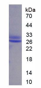 Figure 1. SDS-PAGE