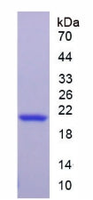 Figure 2. SDS-PAGE