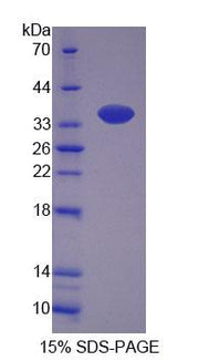Figure 1. SDS-PAGE