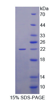 Figure 1. SDS-PAGE