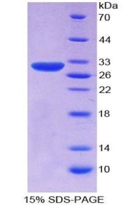 Figure 1. SDS-PAGE